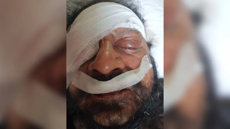 Kanpur: ओवरटेक करने को लेकर विवाद… भाजपा पार्षद और समर्थकों ने व्यापारी को किया मरणासन्न, दबाब के कारण पुलिस दिखी बेबस
